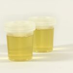 Urine samples SHE Health Clinics