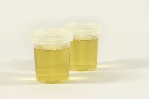 Urine samples SHE Health Clinics